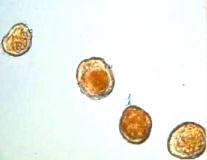 ミツバさび病菌の夏胞子の顕微鏡写真