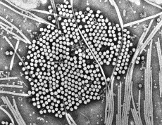 ダイコンモザイクウイルス・プラムポックスウイルスの粒子写真（電子顕微鏡写真）