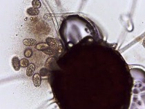 エノキうどんこ病菌の子のう殻（光学顕微鏡写真）