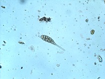 さび斑病分生子 (光学顕微鏡写真)