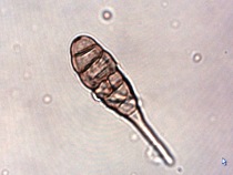 さび斑病分生子 （光学顕微鏡写真）