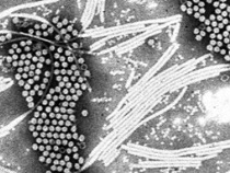 電子顕微鏡で植物ナノ病原体を観察